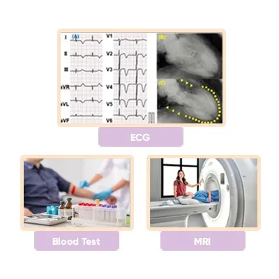 Diagnosis Methods for Broken Heart Syndrome