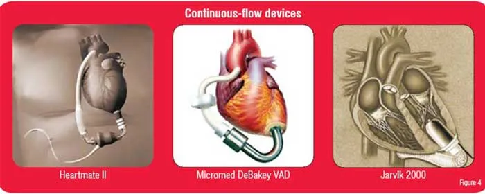 Contionuous Flow Devices
