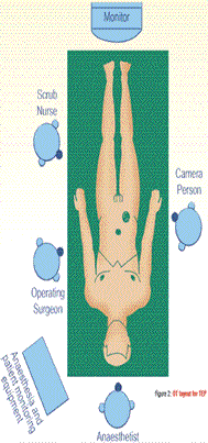 Figure 2: OT layout for TEP