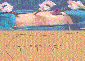 Figure 3 & 4: Port sites
