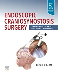 Endoscopic Craniosynostosis Surgery